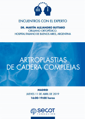 ENCUENTROS CON EL EXPERTO: ARTROPLASTIAS DE CADERA COMPLEJAS