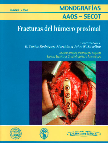 Fracturas del húmero proximal