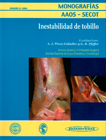 Inestabilidad de tobillo