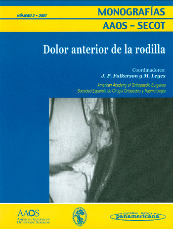 Dolor anterior de la rodilla