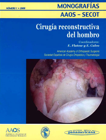 Cirugía reconstructiva de hombro