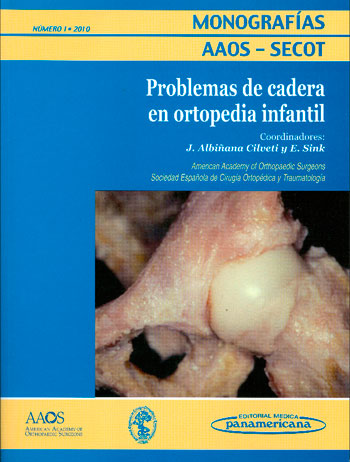 Problemas de cadera en ortopedia infantil