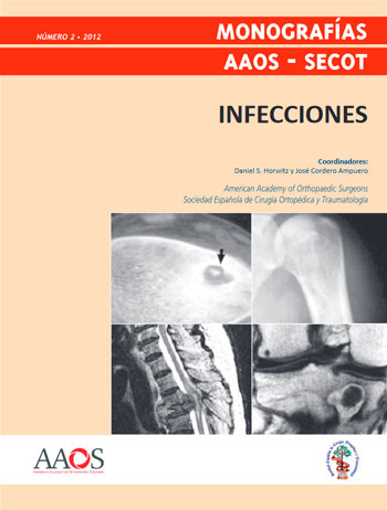 Infecciones