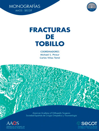 Fracturas de tobillo