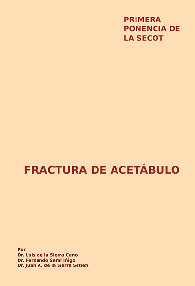 Fractura de acetábulo